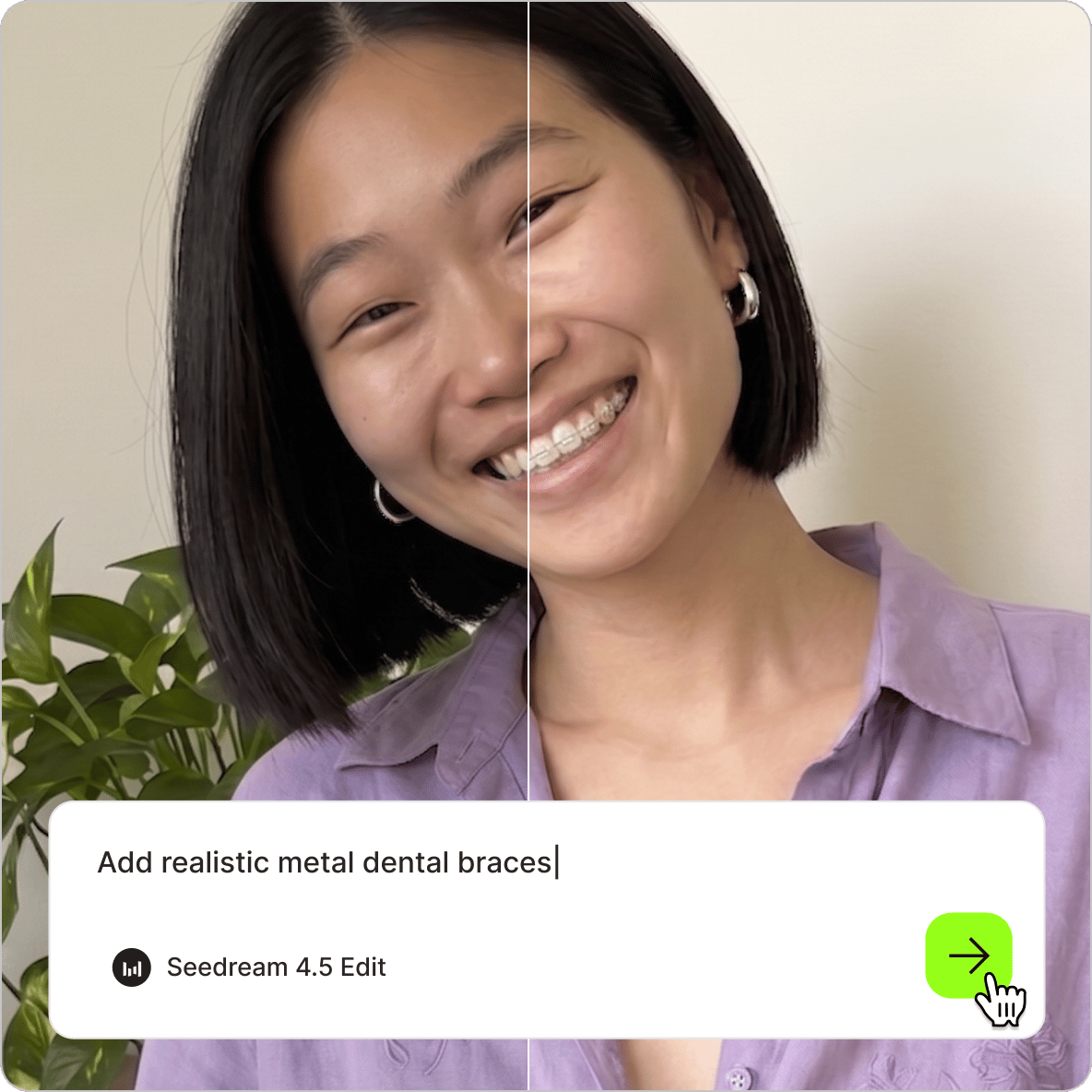 Braces Filter